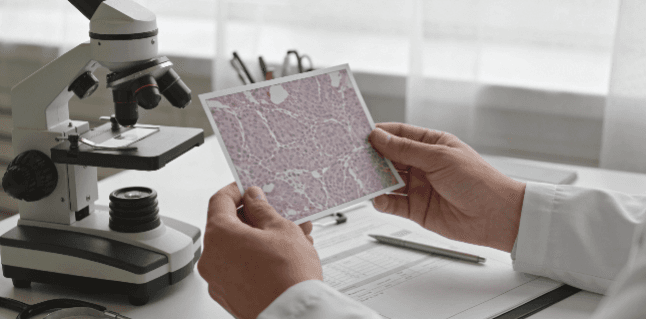 Understanding Your Skin Cancer Pathology Report: Decode HER2, PD-L1, and Ki-67